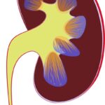 Nephritic syndrome