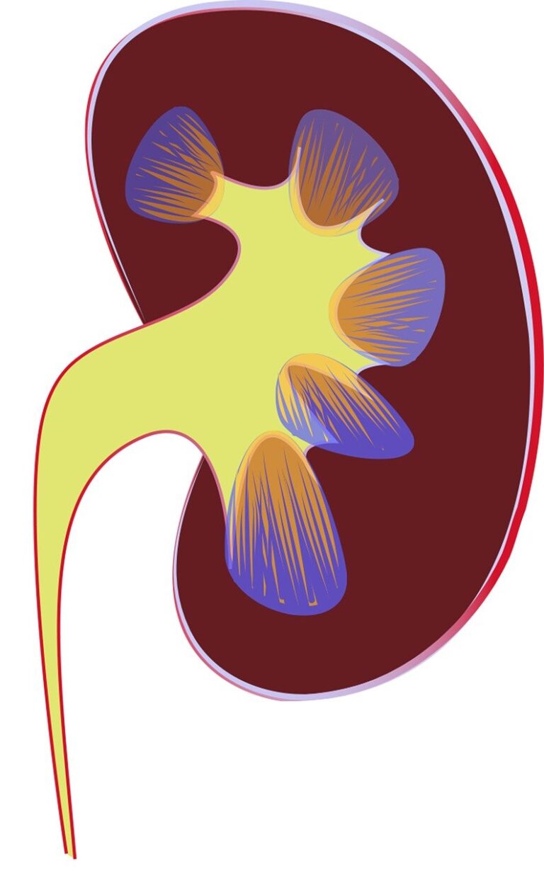 Nephritic syndrome