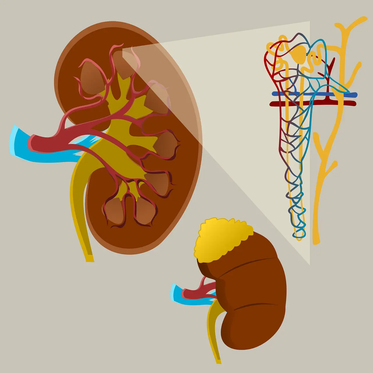 You are currently viewing Nephrotic Syndrome